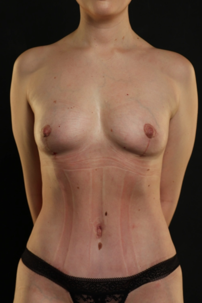 After Image