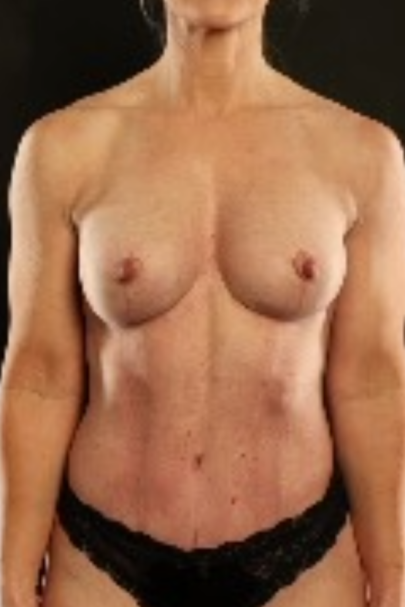 After Image