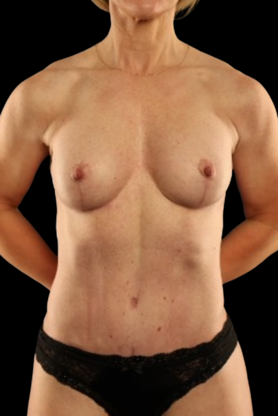 After Image