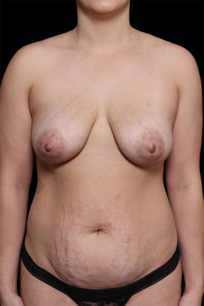 Before Image